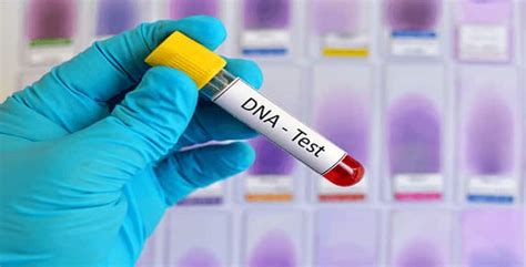 DNA test reveals ex.
